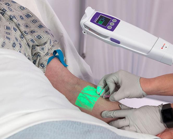 Přístroj na zobrazení žil nyní i v ČR